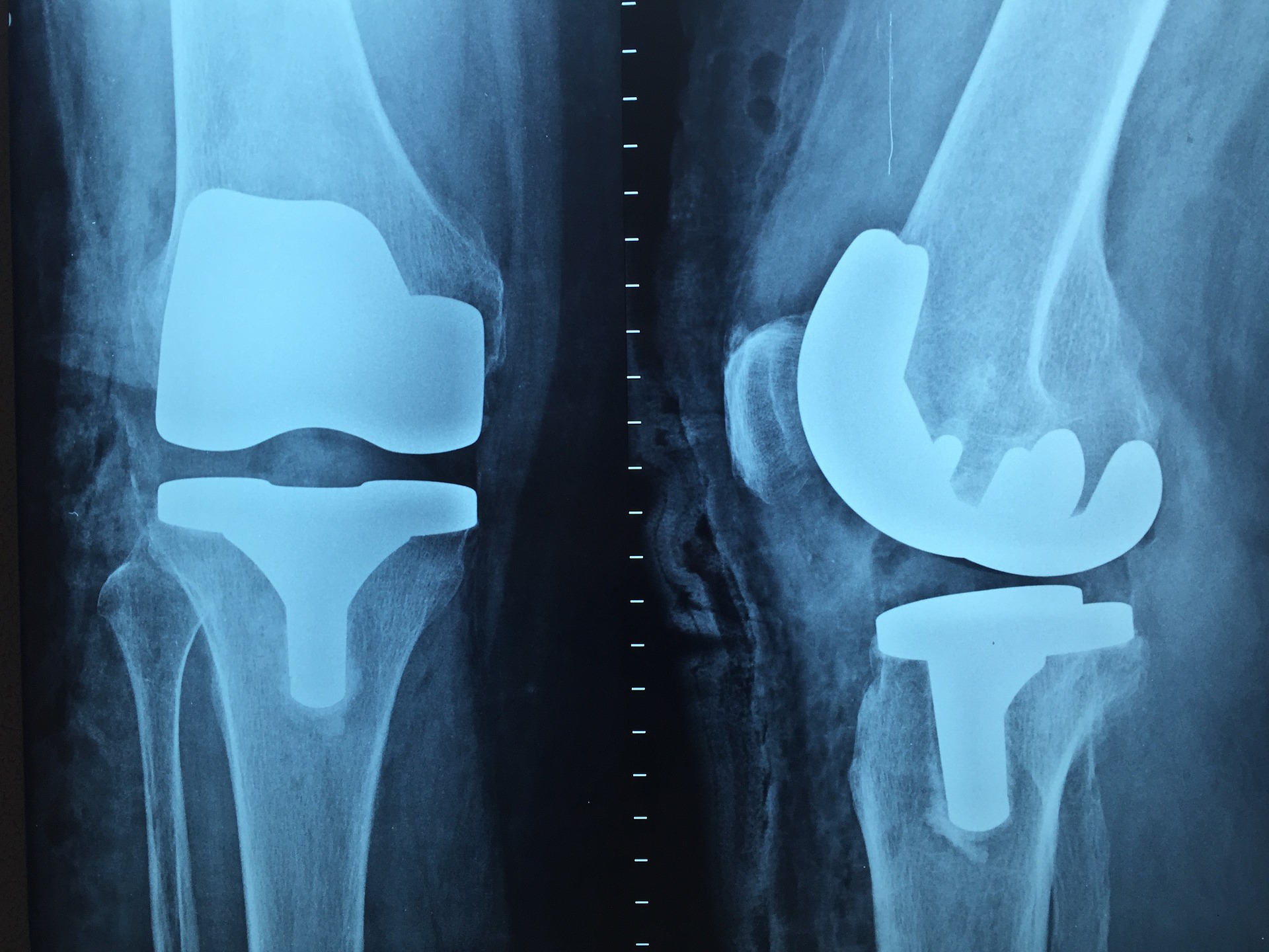 S bolestí zad a nohou na ortopedii